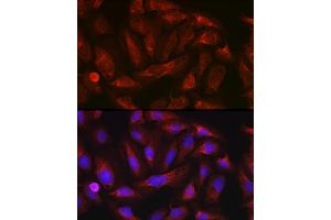 Immunofluorescence analysis of U-2 OS cells using ErbB4/HER4 Rabbit pAb (ABIN6131263, ABIN6140257, ABIN6140260 and ABIN6221732) at dilution of 1:100 (40x lens).