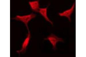 ABIN6275423 staining Hela by IF/ICC. (PLEKHG4 anticorps  (Internal Region))