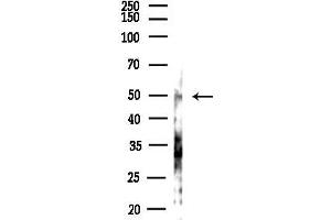 anti-Protein Inhibitor of Activated STAT, 4 (PIAS4) (C-Term) antibody