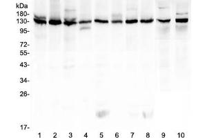 Western blot testing of human 1) K562, 2) HeLa, 3) 293T, 4) A431, 5) Caco-2, 6) PC-3, 7) MCF7, 8) U-2 OS, 9) rat testis and 10) mouse testis lysate with Bub1 antibody at 0. (BUB1 anticorps  (AA 731-1085))