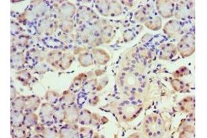 Immunohistochemistry of paraffin-embedded human pancreatic tissue using ABIN7142031 at dilution of 1:100 (ABHD5 anticorps  (AA 1-349))