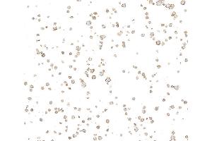 Immunocytochemistry (ICC) image for anti-Ectonucleoside Triphosphate diphosphohydrolase 1 (ENTPD1) (AA 300-350) antibody (ABIN7795686) (Recombinant CD39 anticorps  (AA 300-350))