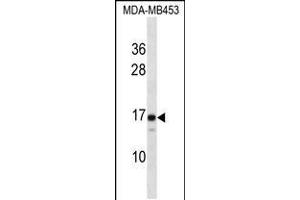 Western blot analysis in MDA-MB453 cell line lysates (35ug/lane).