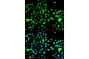 Immunofluorescence analysis of A549 cells using IP6K2 antibody (ABIN6290522). (IP6K2 anticorps)