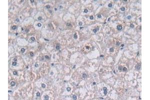 Detection of PON3 in Human Liver Tissue using Polyclonal Antibody to Paraoxonase 3 (PON3)