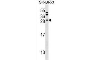 Western Blotting (WB) image for anti-B-Cell CLL/lymphoma 7C (BCL7C) antibody (ABIN2999905) (BCL7C anticorps)