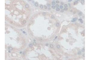 Detection of FSTL1 in Human Kidney Tissue using Polyclonal Antibody to Follistatin Like Protein 1 (FSTL1)