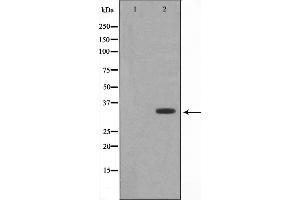 Western blot analysis of DARPP-32 expression in EGF treated 293 whole cell lysates,The lane on the left is treated with the antigen-specific peptide. (DARPP32 anticorps)