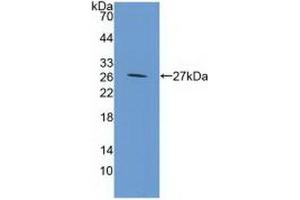 Detection of Recombinant GP39, Mouse using Polyclonal Antibody to Chitinase-3-like Protein 1 (CHI3L1) (CHI3L1 anticorps  (AA 112-356))