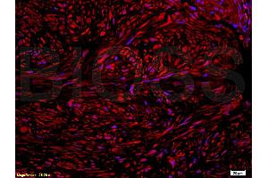 L1 mouse heart, L2 mouse muscle lysates probed (ABIN676673) at 1:200 in 4 °C.