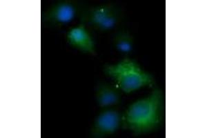 Image no. 13 for anti-Tripartite Motif Containing 38 (TRIM38) (AA 1-265) antibody (ABIN1490681) (TRIM38 anticorps  (AA 1-265))