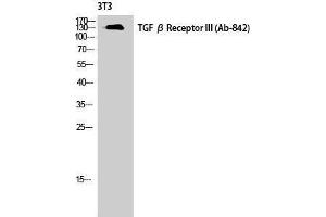 Western Blotting (WB) image for anti-Transforming Growth Factor, beta Receptor III (TGFBR3) (Tyr160) antibody (ABIN3177700) (TGFBR3 anticorps  (Tyr160))