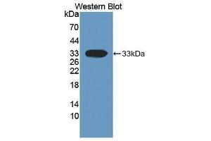 Western Blotting (WB) image for anti-Dickkopf Homolog 1 (DKK1) (AA 33-266) antibody (ABIN3201490) (DKK1 anticorps  (AA 33-266))