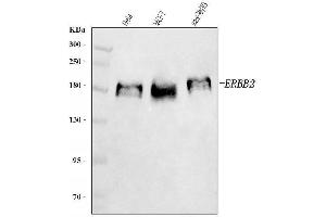 Western blot analysis of HER2/ERBB2 using anti-HER2/ERBB2 antibody (ABIN7600737).