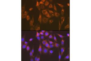 Immunofluorescence analysis of NIH-3T3 cells using Sec23AA Rabbit mAb (ABIN7270168) at dilution of 1:100 (40x lens). (SEC23A anticorps)