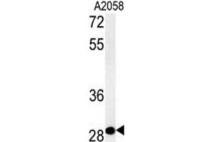 Western Blotting (WB) image for anti-Chromosome 11 Open Reading Frame 46 (C11orf46) antibody (ABIN2995509) (C11orf46 anticorps)