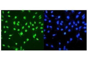 IF analysis of MTA2 using anti-MTA2 antibody (ABIN7599519). (MTA2 anticorps  (AA 1-668))