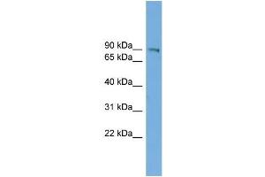 Human HepG2; WB Suggested Anti-UTP14A Antibody Titration: 0. (UTP14A anticorps  (N-Term))