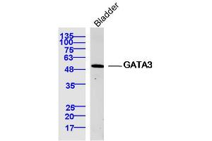 Mouse bladder lysates probed with GATA3 Polyclonal Antibody, Unconjugated  at 1:300 dilution and 4˚C overnight incubation. (GATA3 anticorps  (AA 151-250))