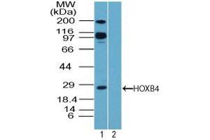 Image no. 1 for anti-Homeobox B4 (HOXB4) (AA 100-150) antibody (ABIN960213) (HOXB4 anticorps  (AA 100-150))