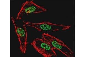 Fluorescent confocal image of HeLa cell stained with MyoD1 antibody at 1:25.