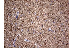 Image no. 3 for anti-Neurofilament, Light Polypeptide (NEFL) (AA 1-360) antibody (ABIN1490762) (NEFL anticorps  (AA 1-360))