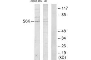 Western blot analysis of extracts from COLO205/Jurkat cells, using S6K Antibody. (RPS6KB1 anticorps  (AA 261-310))