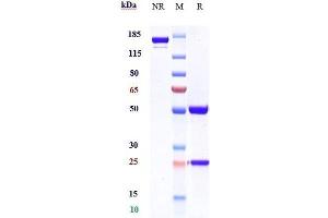 Anti-PCSK9 Reference Antibody (alirocumab) on SDS-PAGE under reducing (R) condition.