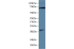 Detection of CAMK2g in Rat Cerebrum lysate using Polyclonal Antibody to Calcium/Calmodulin Dependent Protein Kinase II Gamma (CAMK2g)