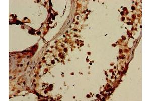 Immunohistochemistry of paraffin-embedded human testis tissue using ABIN7151564 at dilution of 1:100 (ELOVL4 anticorps  (AA 270-314))