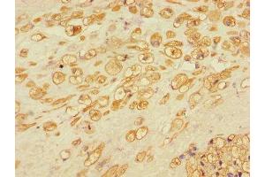 Immunohistochemistry of paraffin-embedded human placental tissue using ABIN7150164 at dilution of 1:100 (Retinoblastoma Binding Protein 8 anticorps  (AA 126-331))