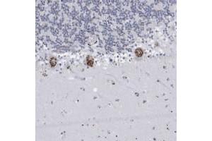 Immunohistochemical staining of human cerebellum with FAM207A polyclonal antibody  shows strong cytoplasmic positivity(granular pattern) in Purkinje cells at 1:200-1:500 dilution. (FAM207A anticorps)