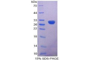 SDS-PAGE (SDS) image for Calbindin 2 (CALB2) (AA 28-248) protein (His tag) (ABIN2124221)