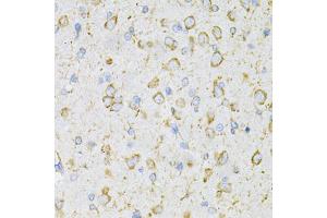 Immunohistochemistry of paraffin-embedded rat brain using LRPAP1 Antibody (ABIN5971543) at dilution of 1/200 (40x lens). (LRPAP1 anticorps)