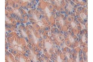 Detection of IL11Ra in Mouse Stomach Tissue using Polyclonal Antibody to Interleukin 11 Receptor Alpha (IL11Ra) (IL11RA anticorps  (AA 194-329))