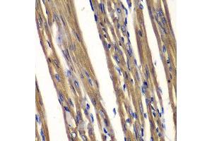 Immunohistochemistry of paraffin-embedded rat heart using PTPN2 antibody.