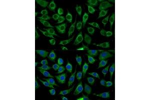 Immunofluorescence analysis of L929 cells using  Polyclonal Antibody (ABIN7266299) at dilution of 1:100 (40x lens). (CCL17 anticorps  (AA 420-500))