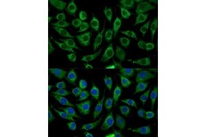 Immunofluorescence analysis of L929 cells using  Polyclonal Antibody (ABIN7266299) at dilution of 1:100 (40x lens). (CCL17 anticorps  (AA 420-500))