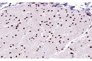 ABIN6267590 at 1/200 staining human Smooth muscle tissue sections by IHC-P. (MEF2A anticorps  (pThr312))