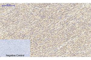 Immunohistochemical analysis of paraffin-embedded human uterus tissue. (TGFB1 anticorps  (AA 310-390))