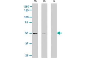 Western blot analysis of ARFGAP1 polyclonal antibody  against rat recombinant ARFGAP1 (30, 10, and 3 ng/lane, left to right) . (ARFGAP1 anticorps  (C-Term))