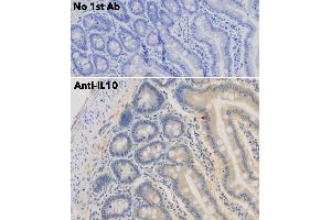 Immunohistochemistry (IHC) image for anti-Interleukin 10 (IL10) antibody (ABIN6254177) (IL-10 anticorps)