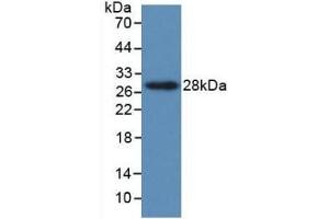 Detection of Recombinant PTHrP, Human using Monoclonal Antibody to Parathyroid Hormone Related Protein (PTHrP) (PTHLH anticorps  (AA 37-177))