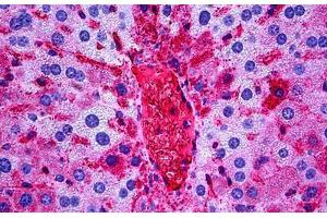 Mouse Liver: Formalin-Fixed, Paraffin-Embedded (FFPE)