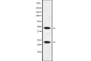 Western blot analysis of APOBEC3A/B using HuvEc whole cell lysates (APOBEC3A/B anticorps)