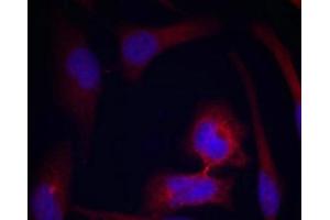 Immunofluorescence staining of methanol-fixed Hela cells using S6 Ribosomal Protein(Phospho-Ser235) Antibody.