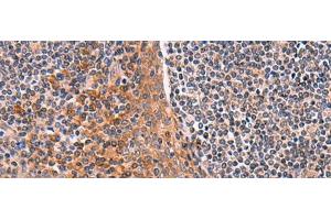Immunohistochemistry of paraffin-embedded Human tonsil tissue using ACYP1 Polyclonal Antibody at dilution of 1:65(x200) (ACYP1 anticorps)