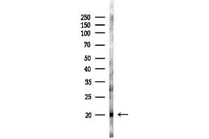 anti-M-Phase phosphoprotein 10 (U3 Small Nucleolar Ribonucleoprotein) (MPHOSPH10) (C-Term) antibody