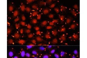 Immunofluorescence analysis of HeLa cells using ACAA1 Polyclonal Antibody at dilution of 1:100 (40x lens). (ACAA1 anticorps)