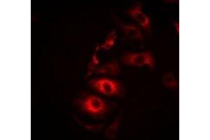 anti-Interleukin 21 (IL21) antibody